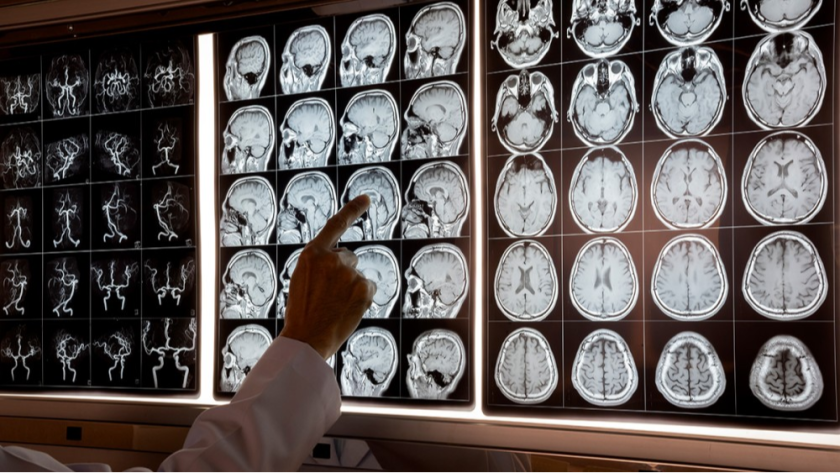 Neurology